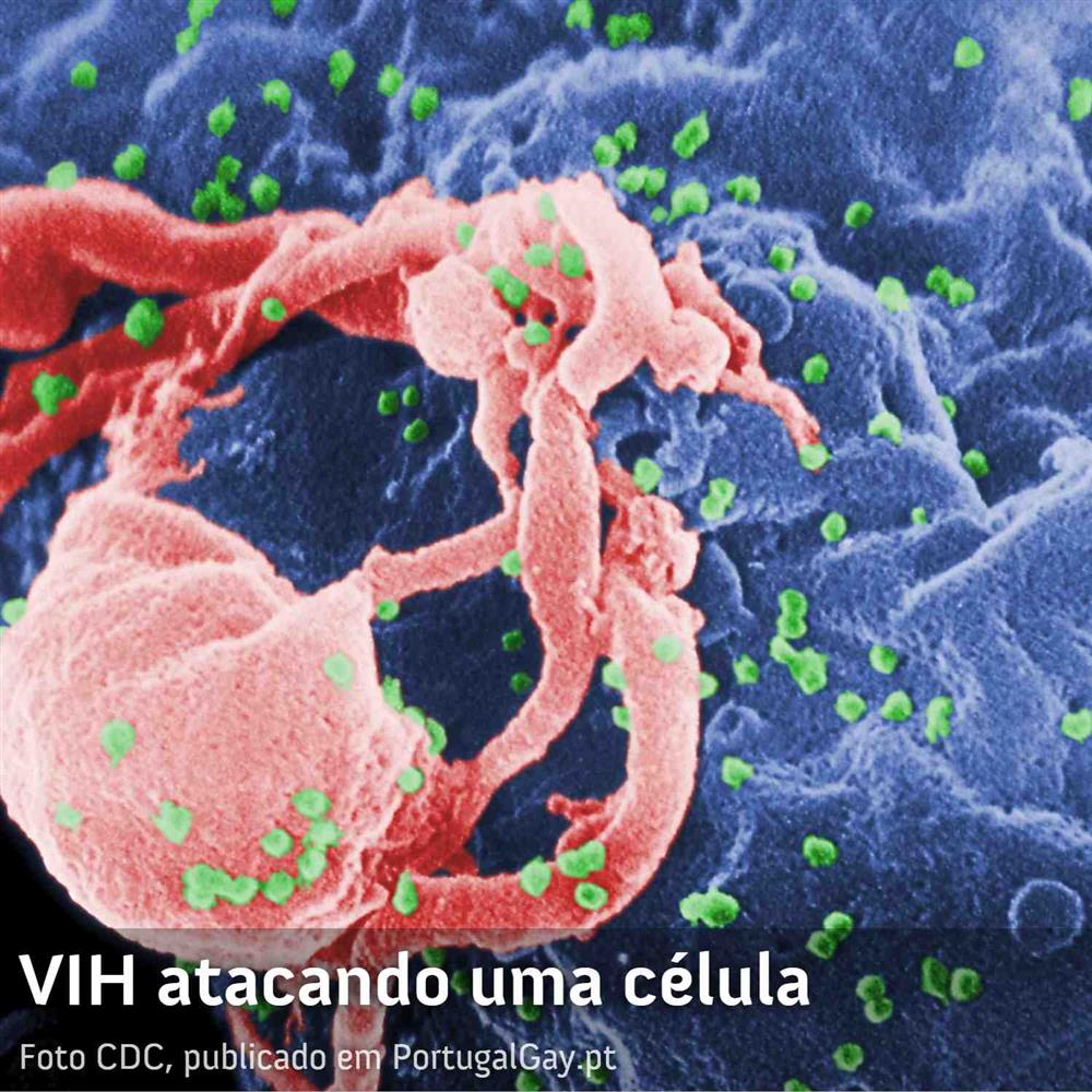 SAÚDE: Testes em humanos de potencial vacina revolucionária contra o VIH