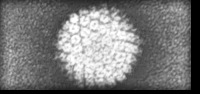 Papilomavirus Humano (Condilomas)